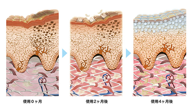 肌の変化